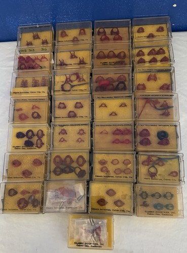 100 lot ring - of,
