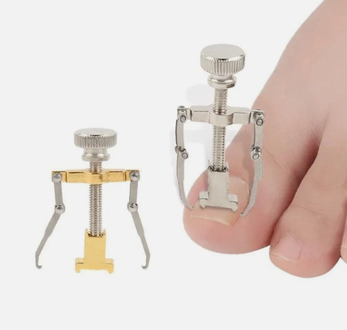 Ingrown toenail treatment toe - toenail,
