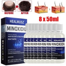 8 Pack Minoxidil 5% Extra