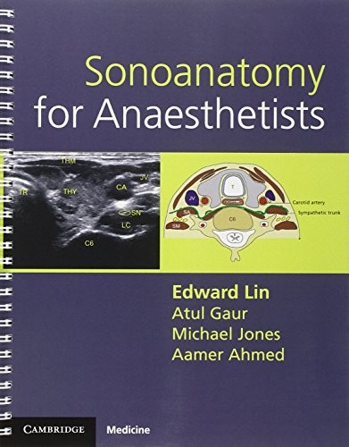 Sonoanatomy for anesthetists - for,