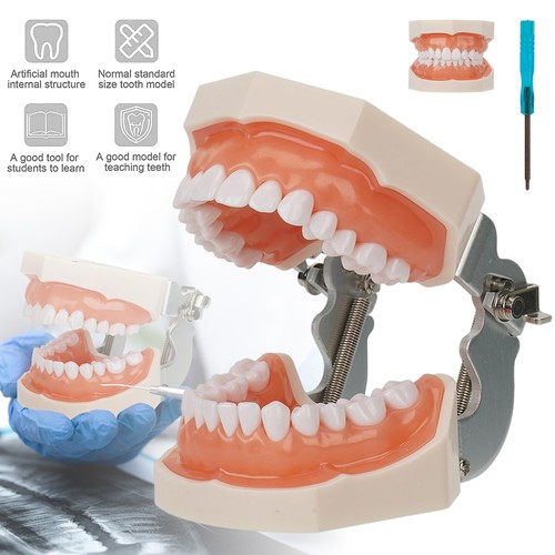 Dental overdenture implant - dental,