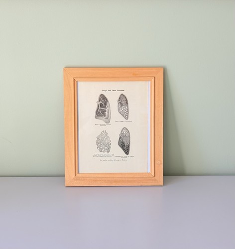Vintage illustration lungs and - vintage,