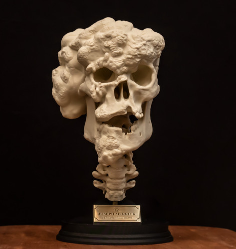 Joseph merrick skull replica - joseph,