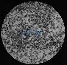 Microscope Photo POTATOE