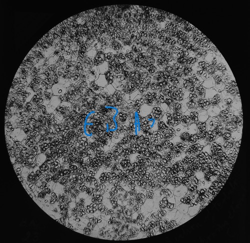 Microscope photo potatoe - photo,