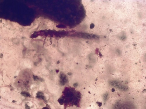 Fossil burmese amber - fossil, larval