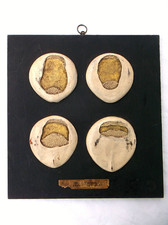 A RARE ANTIQUE ANATOMICAL MODEL OF CHICK EMBRYOLOGY EGG DEVELOPMENT TEACHING AID