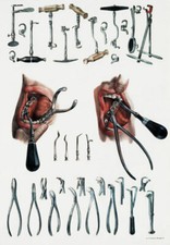 ML21 Vintage 1800's Medical Dentist Tools & Equipment Poster Re-Print A4
