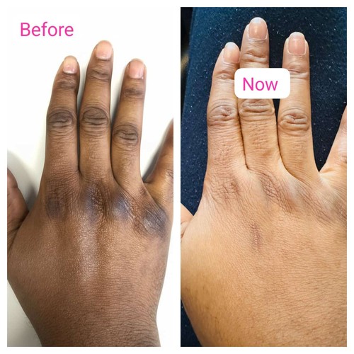 Active dark knuckle remover - active,