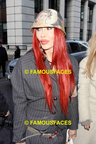Pete burns dead - burns,
