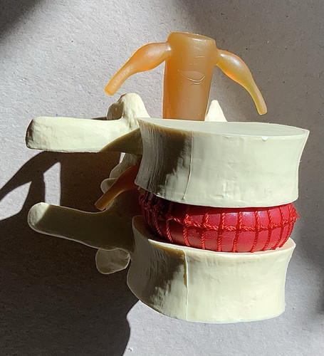 Anatomical spine vertebrae - anatomical,