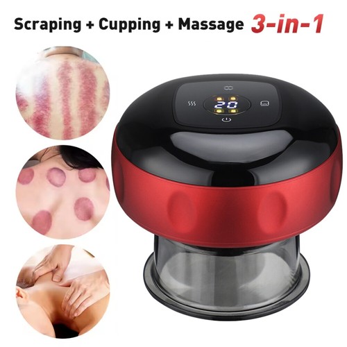 Smart electric cupping - cupping, therapy