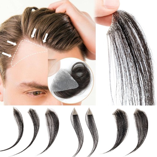 Human hair bald spot - hair,
