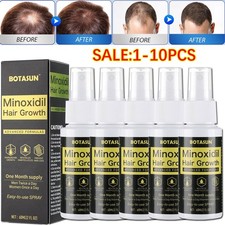 5% Minoxidil Hair Growth Serum Spray for Healthier and Thicker Hair, 60mL