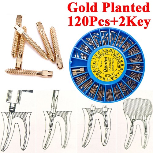 120pcs kit dental screw post - 120pcs/kit,