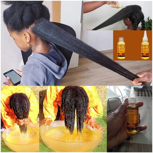 Grow your hair faster - hair,