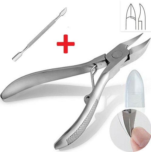 Professional ingrown toe - professional,
