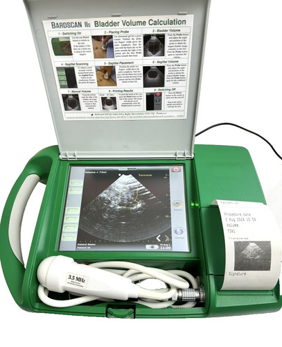 Bardscan iis ultrasound - bardscan,