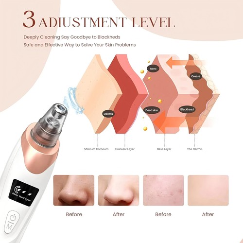 Electric blackhead remover - blackhead,
