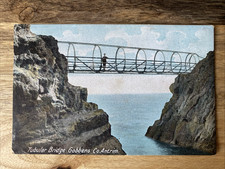 pc vtg tubular bridge gobbens