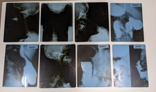 X-Ray Photo Skull & Neck