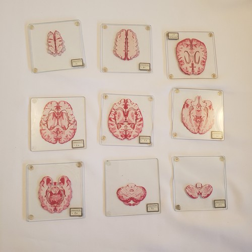 You pick replacement 3d - you,