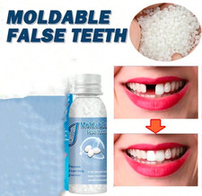 Temporary Tooth Repair Kit Fix Broken Teeth And Fills Gaps Non Toxic uk