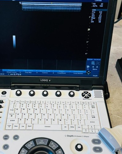 Linear ultrasound - 9l-rs,