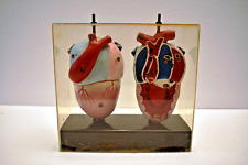 Vintage Anatomical Heart Model in Acrylic Case Educational Medical Display Rare