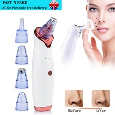 Electric Blackhead Remover