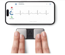 Alivecor KardiaMobile EKG/ECG