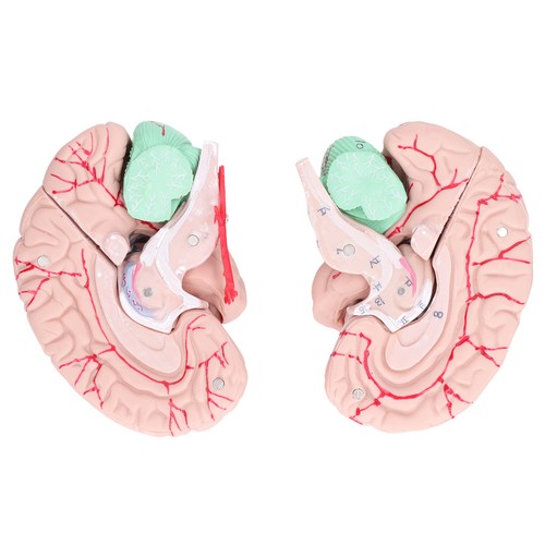 Brain mold human - mold,