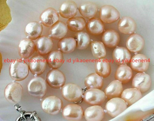 Fashion 9 10mm - 7-8/8-9/9-10mm, pink