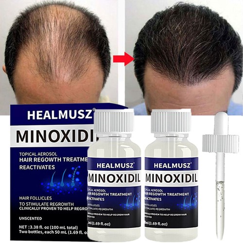 Pack minoxidil extra - pack,