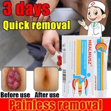 Herbal Haemorrhoid Cream