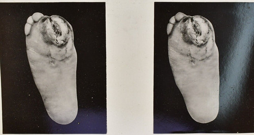 Medical anatomical curiosity - medical,