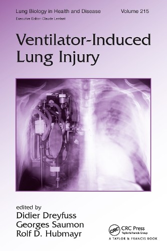 Ventilator induced lung - ventilator-induced, injury