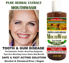 Treat Mouth Ulcers Sensitive