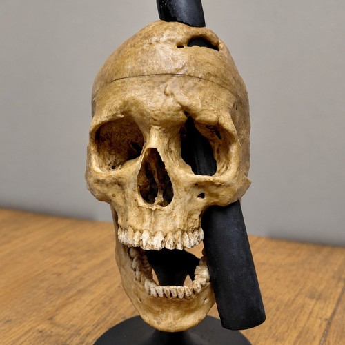 Phineas gage skull - phineas,