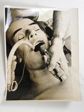 Medical Intubation Anesthesia