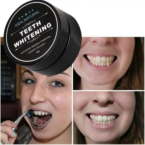 Charcoal teeth tooth whitening - tooth,