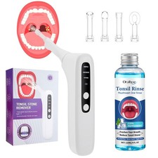 Electronic Tonsil Stone