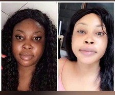 🥰 BEST EXTREME  whitening