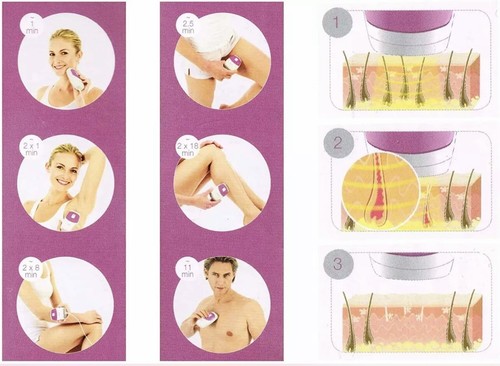 Laser ipl permanent hair - ipl,