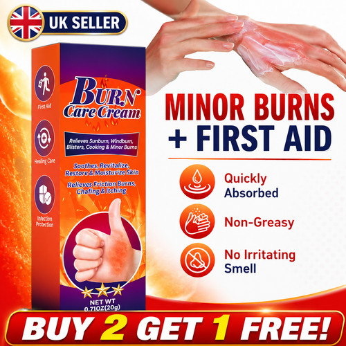 New burn scald cream - burn,
