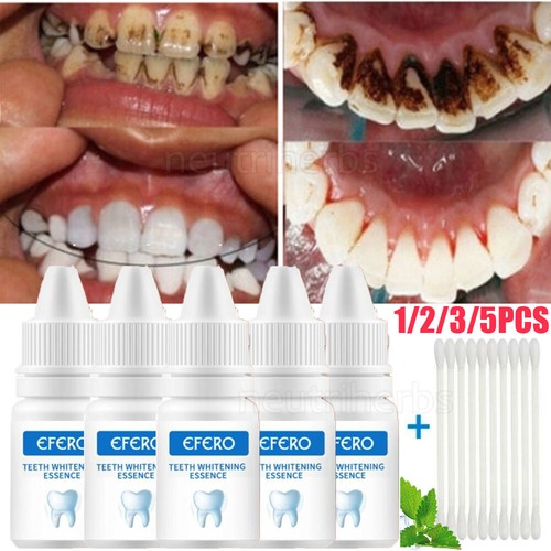Teeth whitening essence - whitening, extra