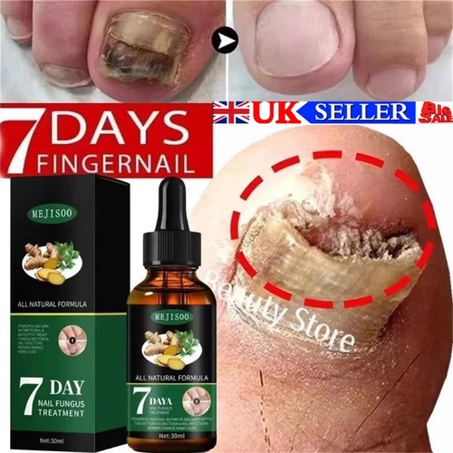 Fungal nail treatment strong - nail,
