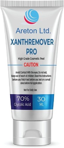 Xanthelasma removal cream - xanthelasma,