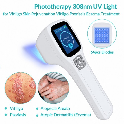 308nm uvb light - 308nm,