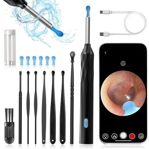 Ear wax removal - removal, 3.5mm